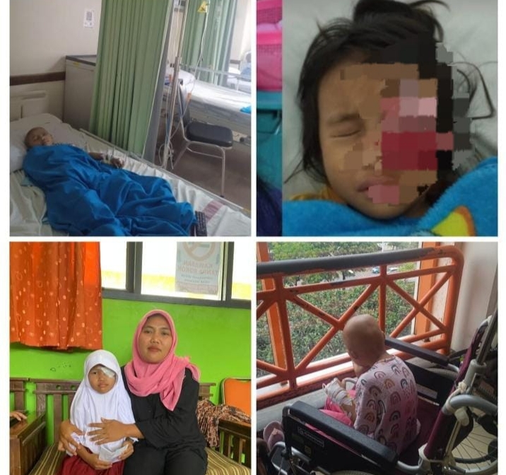 Pemerintah Daerah, Provinsi dan Pusat Tolong Inara Siswi Kelas 1 di Kecamatan Jawilan Terkena Kangker Stadium Empat